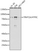 Western blot analysis of extracts of various cell lines, using TRMT2A/HTF9C antibody (CAB21432) at 1:1000 dilution. Secondary antibody: HRP Goat Anti-Rabbit IgG (H+L) at 1:10000 dilution. Lysates/proteins: 25μg per lane. Blocking buffer: 3% nonfat dry milk in TBST.