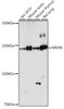 Western blot analysis of extracts of various cell lines, using MSH6 antibody (CAB21445) at 1:1000 dilution. Secondary antibody: HRP Goat Anti-Rabbit IgG (H+L) at 1:10000 dilution. Lysates/proteins: 25μg per lane. Blocking buffer: 3% nonfat dry milk in TBST.