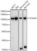 Western blot analysis of various lysates, using IFNAR2 Rabbit pAb antibody (CAB21462) at 1:1000 dilution. Secondary antibody: HRP Goat Anti-Rabbit IgG (H+L) at 1:10000 dilution. Lysates/proteins: 25μg per lane. Blocking buffer: 3% nonfat dry milk in TBST.