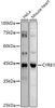 Western blot analysis of extracts of various cell lines, using (CAB21463) at 1:1000 dilution. Secondary antibody: HRP Goat Anti-Rabbit IgG (H+L) at 1:10000 dilution. Lysates/proteins: 25μg per lane. Blocking buffer: 3% nonfat dry milk in TBST.