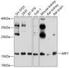 Western blot analysis of extracts of various cell lines, using ARF1 antibody (CAB21474) at 1:1000 dilution. Secondary antibody: HRP Goat Anti-Rabbit IgG (H+L) at 1:10000 dilution. Lysates/proteins: 25μg per lane. Blocking buffer: 3% nonfat dry milk in TBST.