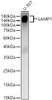 Western blot analysis of lysates from U-937, using LAMP1 Rabbit pAb (CAB21481) at 1:400 dilution. Secondary antibody: HRP Goat Anti-Rabbit IgG (H+L) at 1:10000 dilution. Lysates/proteins: 25ug per lane. Blocking buffer: 3% nonfat dry milk in TBST.