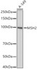 Western blot analysis of A-549, using MSH2 Rabbit pAb antibody (CAB21494) at 1:1000 dilution. Secondary antibody: HRP Goat Anti-Rabbit IgG (H+L) at 1:10000 dilution. Lysates/proteins: 25μg per lane. Blocking buffer: 3% nonfat dry milk in TBST.