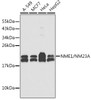 Western blot analysis of extracts of various cell lines, using NME1/NM23A antibody (CAB21512). Secondary antibody: HRP Goat Anti-Rabbit IgG (H+L) at 1:10000 dilution. Lysates/proteins: 25μg per lane. Blocking buffer: 3% nonfat dry milk in TBST.