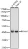 Western blot analysis of various lysates, using PDHA1 Rabbit pAb (CAB21537) at 1:1000 dilution. Secondary antibody: HRP Goat Anti-Rabbit IgG (H+L) at 1:10000 dilution. Lysates/proteins: 25ug per lane. Blocking buffer: 3% nonfat dry milk in TBST.