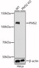 Western blot analysis of extracts from wild type(WT) and PMS2 knockout (KO) HeLa(KO) cells, using PMS2 antibody (CAB21547) at 1:1000 dilution. Secondary antibody: HRP Goat Anti-Rabbit IgG (H+L) at 1:10000 dilution. Lysates/proteins: 25μg per lane. Blocking buffer: 3% nonfat dry milk in TBST.
