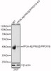 Western blot analysis of extracts from wild type(WT) and PP2A-Aβ/PR65β/PPP2R1B knockout (KO) hek293T(KO) cells, using PP2A-Aβ/PR65β/PPP2R1B antibody (CAB21559) at 1:1000 dilution. Secondary antibody: HRP Goat Anti-Rabbit IgG (H+L) at 1:10000 dilution. Lysates/proteins: 25μg per lane. Blocking buffer: 3% nonfat dry milk in TBST.