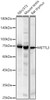 Western blot analysis of various lysates, using METTL3 Rabbit pAb (CAB21572) at 1:1000 dilution. Secondary antibody: HRP Goat Anti-Rabbit IgG (H+L) at 1:10000 dilution. Lysates/proteins: 25μg per lane. Blocking buffer: 3% nonfat dry milk in TBST.