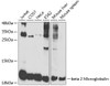 Western blot analysis of extracts of various cell lines, using beta 2 Microglobulin antibody (CAB21573) at 1:1000 dilution. Secondary antibody: HRP Goat Anti-Rabbit IgG (H+L) at 1:10000 dilution. Lysates/proteins: 25μg per lane. Blocking buffer: 3% nonfat dry milk in TBST.