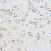 Immunohistochemistry analysis of paraffin-embedded mouse brain using STIM1 Rabbit pAb (CAB21614) at dilution of 1:100 (40x lens). Perform microwave antigen retrieval with 10 mM PBS buffer pH 7. 2 before commencing with IHC staining protocol.