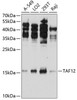 Western blot analysis of extracts of various cell lines, using TAF12 antibody (CAB21616) at 1:1000 dilution. Secondary antibody: HRP Goat Anti-Rabbit IgG (H+L) at 1:10000 dilution. Lysates/proteins: 25μg per lane. Blocking buffer: 3% nonfat dry milk in TBST.