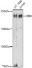 Western blot analysis of extracts of various cell lines, using ZEB1 antibody (CAB21617) at 1:1000 dilution. Secondary antibody: HRP Goat Anti-Rabbit IgG (H+L) at 1:10000 dilution. Lysates/proteins: 25μg per lane. Blocking buffer: 3% nonfat dry milk in TBST.