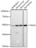 Western blot analysis of extracts of various cell lines, using TRAF6 antibody (CAB21637) at 1:1000 dilution. Secondary antibody: HRP Goat Anti-Rabbit IgG (H+L) at 1:10000 dilution. Lysates/proteins: 25μg per lane. Blocking buffer: 3% nonfat dry milk in TBST.