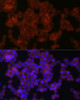 Immunofluorescence analysis of 293T cells using AXIN2 Rabbit pAb (CAB21674) at dilution of 1:100 (40x lens). Blue: DAPI for nuclear staining.