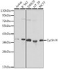 Western blot analysis of extracts of various cell lines, using Cyclin H Antibody (CAB21703). Secondary antibody: HRP Goat Anti-Rabbit IgG (H+L) at 1:10000 dilution. Lysates/proteins: 25μg per lane. Blocking buffer: 3% nonfat dry milk in TBST.