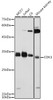 Western blot analysis of extracts of various cell lines, using CDK1 antibody (CAB21725) at 1:1000 dilution. Secondary antibody: HRP Goat Anti-Rabbit IgG (H+L) at 1:10000 dilution. Lysates/proteins: 25μg per lane. Blocking buffer: 3% nonfat dry milk in TBST.