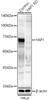 Western blot analysis of extracts from normal (control) and YAP1 knockout (KO) HeLa cells, using YAP1 antibody (CAB21732) at 1:500 dilution. Secondary antibody: HRP Goat Anti-Rabbit IgG (H+L) at 1:10000 dilution. Lysates/proteins: 25μg per lane. Blocking buffer: 3% nonfat dry milk in TBST.