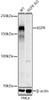 Western blot analysis of extracts from wild type(WT) and EGFR knockout (KO) HeLa cells, using EGFR antibody (CAB21740) at 1:1000 dilution. Secondary antibody: HRP Goat Anti-Rabbit IgG (H+L) at 1:10000 dilution. Lysates/proteins: 25μg per lane. Blocking buffer: 3% nonfat dry milk in TBST.