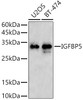 Western blot analysis of extracts of various cell lines, using IGFBP5 antibody (CAB21745) at 1:1000 dilution. Secondary antibody: HRP Goat Anti-Rabbit IgG (H+L) at 1:10000 dilution. Lysates/proteins: 25μg per lane. Blocking buffer: 3% nonfat dry milk in TBST.