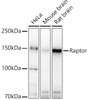 Western blot analysis of various lysates, using Raptor Rabbit pAb (CAB21756) at 1:500 dilution. Secondary antibody: HRP Goat Anti-Rabbit IgG (H+L) at 1:10000 dilution. Lysates/proteins: 25ug per lane. Blocking buffer:3% nonfat dry milk in TBST.