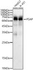 Western blot analysis of various lysates, using PSAP Rabbit pAb antibody (CAB21761) at 1:1000 dilution. Secondary antibody: HRP Goat Anti-Rabbit IgG (H+L) at 1:10000 dilution. Lysates/proteins: 25μg per lane. Blocking buffer: 3% nonfat dry milk in TBST.