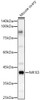 Western blot analysis of Mouse ovary, using NR1I3 antibody (CAB21765) at 1:700 dilution. Secondary antibody: HRP Goat Anti-Rabbit IgG (H+L) at 1:10000 dilution. Lysates/proteins: 25μg per lane. Blocking buffer: 3% nonfat dry milk in TBST.