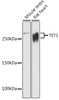 Western blot analysis of extracts of various cell lines, using TET1 antibody (CAB21766) at 1:1000 dilution. Secondary antibody: HRP Goat Anti-Rabbit IgG (H+L) at 1:10000 dilution. Lysates/proteins: 25μg per lane. Blocking buffer: 3% nonfat dry milk in TBST.