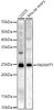 Western blot analysis of various lysates, using N6AMT1 Rabbit pAb (CAB21784) at 1:500 dilution. Secondary antibody: HRP Goat Anti-Rabbit IgG (H+L) at 1:10000 dilution. Lysates/proteins: 25ug per lane. Blocking buffer:3% nonfat dry milk in TBST.