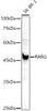 Western blot analysis of extracts of SK-BR-3 cells, using RARG antibody (CAB21785) at 1:1000 dilution. Secondary antibody: HRP Goat Anti-Rabbit IgG (H+L) at 1:10000 dilution. Lysates/proteins: 25μg per lane. Blocking buffer: 3% nonfat dry milk in TBST.