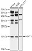 Western blot analysis of various lysates, using HINT1 antibody (CAB21797) at 1:1000 dilution. Secondary antibody: HRP Goat Anti-Rabbit IgG (H+L) at 1:10000 dilution. Lysates/proteins: 25μg per lane. Blocking buffer: 3% nonfat dry milk in TBST.