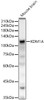 Western blot analysis of Mouse brain, using KDM1A antibody (CAB21801) at 1:500 dilution. Secondary antibody: HRP Goat Anti-Rabbit IgG (H+L) at 1:10000 dilution. Lysates/proteins: 25μg per lane. Blocking buffer: 3% nonfat dry milk in TBST.