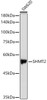 Western blot analysis of SW620, using SHMT2 Rabbit pAb (CAB21803) at 1:1000 dilution. Secondary antibody: HRP Goat Anti-Rabbit IgG (H+L) at 1:10000 dilution. Lysates/proteins: 25ug per lane. Blocking buffer: 3% nonfat dry milk in TBST.