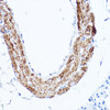 Immunohistochemistry analysis of paraffin-embedded Mouse lung using LDL Receptor (LDLR) antibody (CAB21806) at dilution of 1:100 (40x lens). Perform high pressure antigen retrieval with 10 mM citrate buffer pH 6. 0 before commencing with IHC staining protocol.
