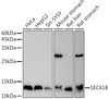Western blot analysis of extracts of various cell lines, using SEC61B antibody (CAB21807) at 1:1000 dilution. Secondary antibody: HRP Goat Anti-Rabbit IgG (H+L) at 1:10000 dilution. Lysates/proteins: 25μg per lane. Blocking buffer: 3% nonfat dry milk in TBST.