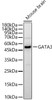 Western blot analysis of Mouse brain, using GATA3 Rabbit pAb (CAB21809) at 1:1000 dilution. Secondary antibody: HRP Goat Anti-Rabbit IgG (H+L) at 1:10000 dilution. Lysates/proteins: 25ug per lane. Blocking buffer: 3% nonfat dry milk in TBST.