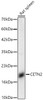 Western blot analysis of Rat spleen, using CETN2 Rabbit pAb (CAB21821) at 1:5000 dilution. Secondary antibody: HRP Goat Anti-Rabbit IgG (H+L) at 1:10000 dilution. Lysates/proteins: 25ug per lane. Blocking buffer: 3% nonfat dry milk in TBST.