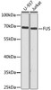 Western blot analysis of extracts of various cell lines, using FUS antibody (CAB21830) at 1:1000 dilution. Secondary antibody: HRP Goat Anti-Rabbit IgG (H+L) at 1:10000 dilution. Lysates/proteins: 25μg per lane. Blocking buffer: 3% nonfat dry milk in TBST.