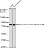 Western blot analysis of extracts of various cell lines, using MST1/MST1/MST1/MST1/STK4 Rabbit pAb (CAB21842) at1:1000 dilution. Secondary antibody: HRP Goat Anti-Rabbit IgG (H+L) at 1:10000 dilution. Lysates/proteins: 25μg per lane. Blocking buffer: 3% nonfat dry milk in TBST.