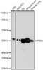Western blot analysis of extracts of various cell lines, using PTEN Rabbit mAb antibody (CAB21892) at 1:1000 dilution. Secondary antibody: HRP Goat Anti-Rabbit IgG (H+L) at 1:10000 dilution. Lysates/proteins: 25μg per lane. Blocking buffer: 3% nonfat dry milk in TBST.
