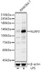 Western blot analysis of RAW264. 7, using NLRP3 antibody (CAB21906) at 1:700 dilution. Raw264. 7 cells were treated by LPS (1 μg/ml) at 37℃ for 8 hours. Secondary antibody: HRP Goat Anti-Rabbit IgG (H+L) at 1:10000 dilution. Lysates/proteins: 25μg per lane. Blocking buffer: 3% nonfat dry milk in TBST.