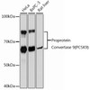 Western blot analysis of extracts of various cell lines, using Proprotein Convertase 9(PCSK9) Rabbit mAb (CAB21909) at 1：1000 dilution. Secondary antibody: HRP Goat Anti-Rabbit IgG (H+L) at 1:10000 dilution. Lysates/proteins: 25μg per lane. Blocking buffer: 3% nonfat dry milk in TBST.