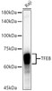 Western blot analysis of extracts of Raji cells, using TFEB antibody (CAB21928) at1:2000 dilution. Secondary antibody: HRP Goat Anti-Rabbit IgG (H+L) at 1:10000 dilution. Lysates/proteins: 25μg per lane. Blocking buffer: 3% nonfat dry milk in TBST.