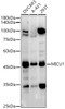 Western blot analysis of various lysates, using MICU1 antibody (CAB21948) at 1:500 dilution. Secondary antibody: HRP Goat Anti-Rabbit IgG (H+L) at 1:10000 dilution. Lysates/proteins: 25μg per lane. Blocking buffer: 3% nonfat dry milk in TBST.