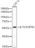 Western blot analysis of extracts of C2C12 cells, using β-TrCP/BTRC Rabbit mAb antibody (CAB21951) at1:1000 dilution. Secondary antibody: HRP Goat Anti-Rabbit IgG (H+L) at 1:10000 dilution. Lysates/proteins: 25μg per lane. Blocking buffer: 3% nonfat dry milk in TBST.