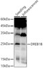 Western blot analysis of extracts of various tissues from Arabidopsis thaliana, using DREB1B antibody (CAB21961) at 1:1000 dilution. Secondary antibody: HRP Goat Anti-Rabbit IgG (H+L) at 1:10000 dilution. Lysates/proteins: 25μg per lane. Blocking buffer: 3% nonfat dry milk in TBST.