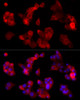 Immunofluorescence analysis of HepG2 using ABCA1 Rabbit mAb (CAB21976) at dilution of 1:200、1：1000 (40x lens). Blue: DAPI for nuclear staining.