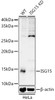 Western blot analysis of extracts from wild type(WT) and ISG15 Rabbit pAb knockdown (KD) HeLa cells, using ISG15 Rabbit pAb antibody (CAB21995) at 1:1000 dilution. Secondary antibody: HRP Goat Anti-Rabbit IgG (H+L) at 1:10000 dilution. Lysates/proteins: 25μg per lane. Blocking buffer: 3% nonfat dry milk in TBST.