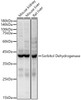 Western blot analysis of various lysates, using Sorbitol Dehydrogenase Rabbit pAb (CAB22009) at 1:1000 dilution. Secondary antibody: HRP Goat Anti-Rabbit IgG (H+L) at 1:10000 dilution. Lysates/proteins: 25ug per lane. Blocking buffer: 3% nonfat dry milk in TBST.