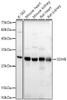 Western blot analysis of extracts of various cell lines, using SDHB antibody (CAB22020) at 1:400 dilution. Secondary antibody: HRP Goat Anti-Rabbit IgG (H+L) at 1:10000 dilution. Lysates/proteins: 25μg per lane. Blocking buffer: 3% nonfat dry milk in TBST.