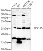 Western blot analysis of extracts of various cell lines, using RPL13A antibody (CAB22023) at 1:500 dilution. Secondary antibody: HRP Goat Anti-Rabbit IgG (H+L) at 1:10000 dilution. Lysates/proteins: 25μg per lane. Blocking buffer: 3% nonfat dry milk in TBST.
